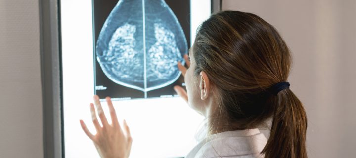 Unrecognizable female gynocologist looking at a patients mammogram at the hospital